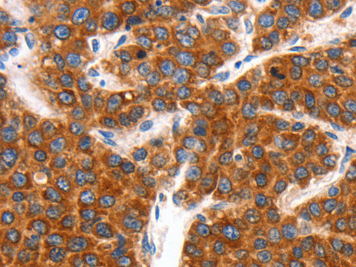 KCNC2 Polyclonal Antibody Store at -20°C, Biomarkers, Elabscience Biotechnology, MSE Supplies