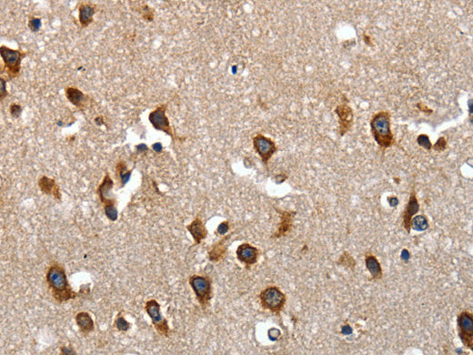 LAMA1 Polyclonal Antibody Store at -20°C, Biomarkers, Elabscience Biotechnology, MSE Supplies