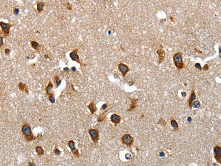 LAMA1 Polyclonal Antibody Store at -20°C, Biomarkers, Elabscience Biotechnology, MSE Supplies