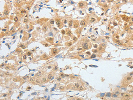 BPIFB2 Polyclonal Antibody Store at -20°C, Biomarkers, Elabscience Biotechnology, MSE Supplies