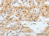 BPIFB2 Polyclonal Antibody Store at -20°C, Biomarkers, Elabscience Biotechnology, MSE Supplies