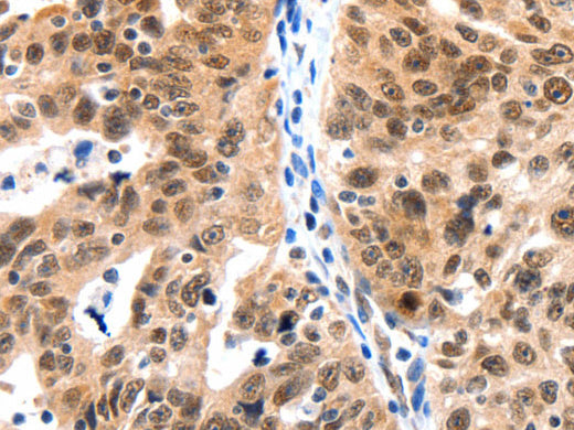 LRP5 Polyclonal Antibody Store at -20°C, Biomarkers, Elabscience Biotechnology, MSE Supplies