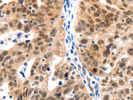 LRP5 Polyclonal Antibody Store at -20°C, Biomarkers, Elabscience Biotechnology, MSE Supplies