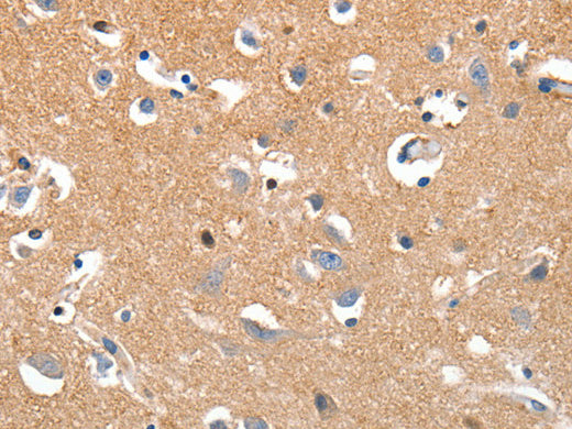 LRP3 Polyclonal Antibody Store at -20°C, Biomarkers, Elabscience Biotechnology, MSE Supplies