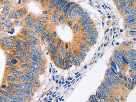 MC1R Polyclonal Antibody Store at -20°C, Biomarkers, Elabscience Biotechnology, MSE Supplies