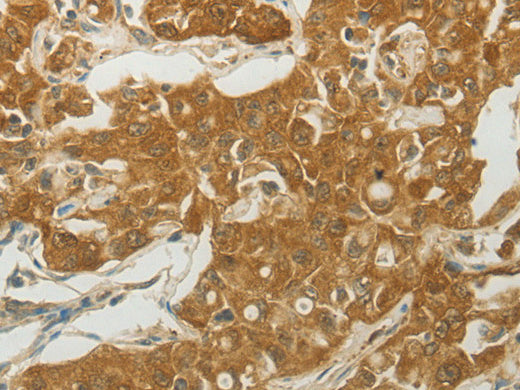 MC4R Polyclonal Antibody Store at -20°C, Biomarkers, Elabscience Biotechnology, MSE Supplies