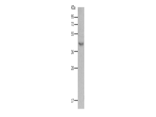 MC5R Polyclonal Antibody Store at -20°C, Biomarkers, Elabscience Biotechnology, MSE Supplies