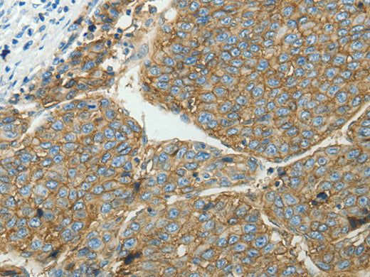 SLC16A1 Polyclonal Antibody Store at -20°C, Biomarkers, Elabscience Biotechnology, MSE Supplies