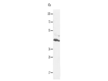 SLC16A7 Polyclonal Antibody Store at -20°C, Biomarkers, Elabscience Biotechnology, MSE Supplies