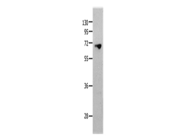 MMP25 Polyclonal Antibody Store at -20°C, Biomarkers, Elabscience Biotechnology, MSE Supplies