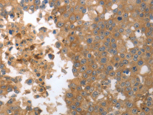 MMP27 Polyclonal Antibody Store at -20°C, Biomarkers, Elabscience Biotechnology, MSE Supplies