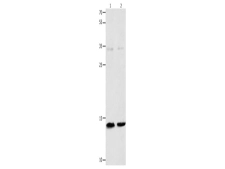 MYL9 Polyclonal Antibody Store at -20°C, Biomarkers, Elabscience Biotechnology, MSE Supplies