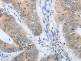 CHRNA10 Polyclonal Antibody Store at -20°C, Biomarkers, Elabscience Biotechnology, MSE Supplies