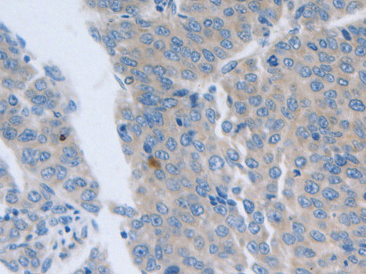 GRIN1 Polyclonal Antibody Store at -20°C, Biomarkers, Elabscience Biotechnology, MSE Supplies