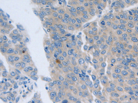 GRIN1 Polyclonal Antibody Store at -20°C, Biomarkers, Elabscience Biotechnology, MSE Supplies