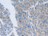 GRIN1 Polyclonal Antibody Store at -20°C, Biomarkers, Elabscience Biotechnology, MSE Supplies