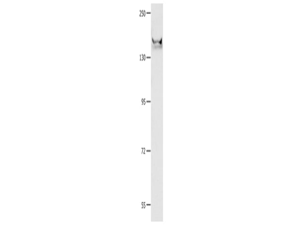 GRIN2B Polyclonal Antibody Store at -20°C, Biomarkers, Elabscience Biotechnology, MSE Supplies
