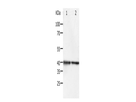 PDX1 Polyclonal Antibody Store at -20°C - Biomarkers - Elabscience Biotechnology - MSE Supplies