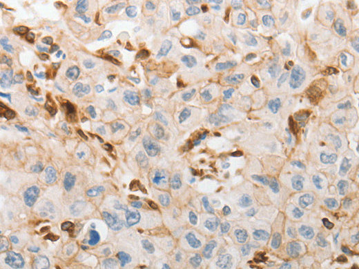 SLC15A2 Polyclonal Antibody Store at -20°C - Biomarkers - Elabscience Biotechnology - MSE Supplies