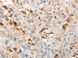 SLC15A2 Polyclonal Antibody Store at -20°C