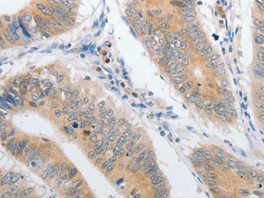 PIBF1 Polyclonal Antibody Store at -20°C - Biomarkers - Elabscience Biotechnology - MSE Supplies