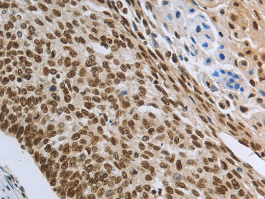 PRMT3 Polyclonal Antibody Store at -20°C - Biomarkers - Elabscience Biotechnology - MSE Supplies