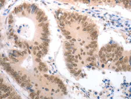 RAD52 Polyclonal Antibody Store at -20°C - Biomarkers - Elabscience Biotechnology - MSE Supplies