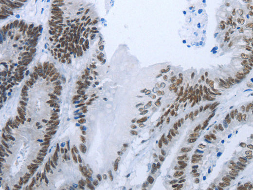 RBMS1 Polyclonal Antibody Store at -20°C - Biomarkers - Elabscience Biotechnology - MSE Supplies
