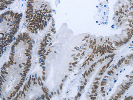 RBMS1 Polyclonal Antibody Store at -20°C - Biomarkers - Elabscience Biotechnology - MSE Supplies