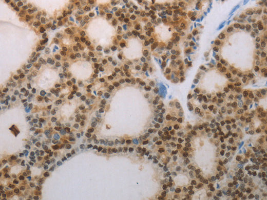 S100A1 Polyclonal Antibody Store at -20°C - Biomarkers - Elabscience Biotechnology - MSE Supplies