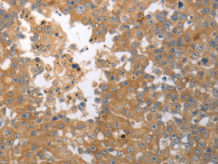 SHH Polyclonal Antibody Store at -20°C - Biomarkers - Elabscience Biotechnology - MSE Supplies