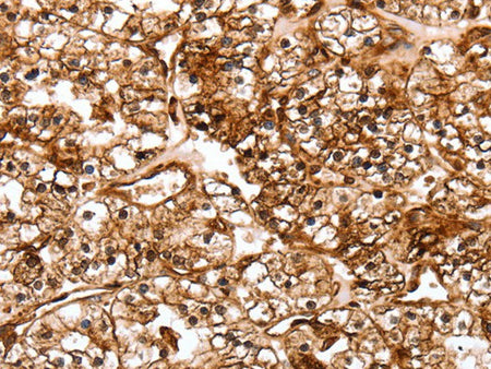 SLC9A3R2 Polyclonal Antibody Store at -20°C - Biomarkers - Elabscience Biotechnology - MSE Supplies