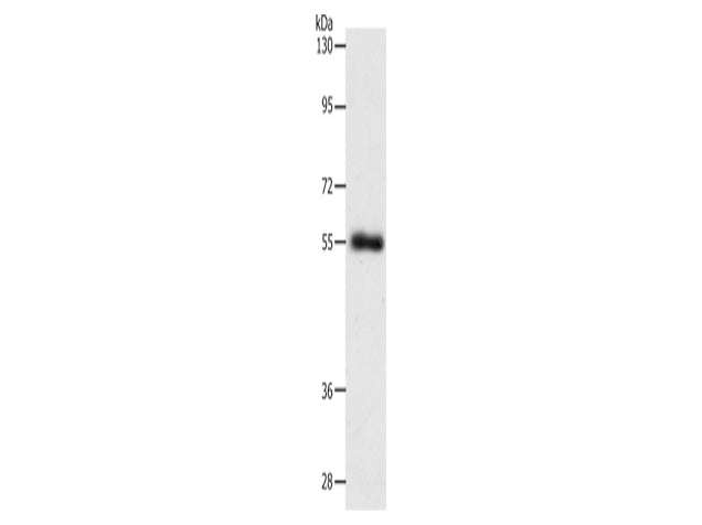 SLC1A5 Polyclonal Antibody Store at -20°C - Biomarkers - Elabscience Biotechnology - MSE Supplies