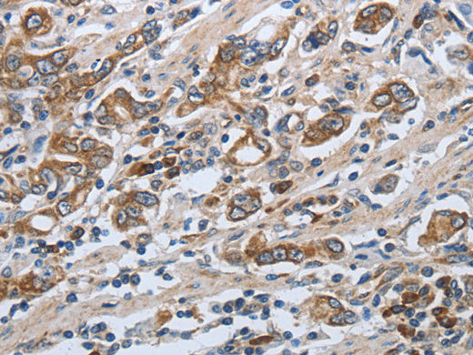 SLC34A2 Polyclonal Antibody Store at -20°C - Biomarkers - Elabscience Biotechnology - MSE Supplies