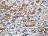 SLC34A2 Polyclonal Antibody Store at -20°C