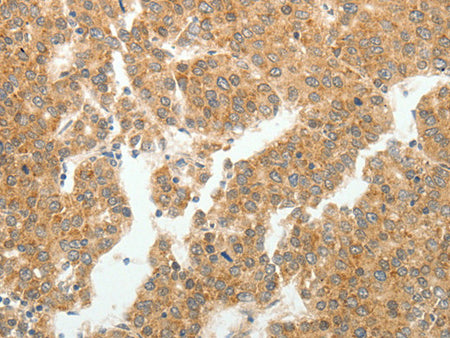 GEMIN2 Polyclonal Antibody Store at -20°C - Biomarkers - Elabscience Biotechnology - MSE Supplies