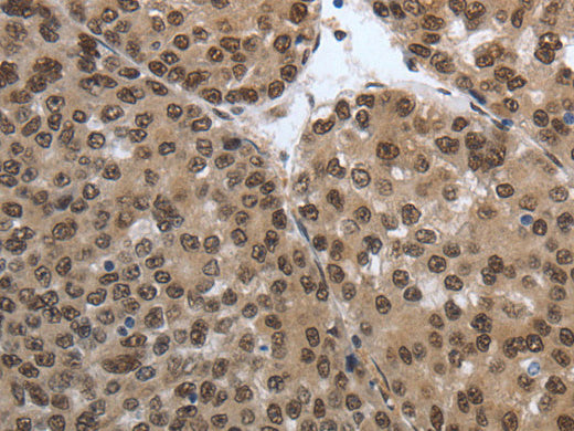 SMAD7 Polyclonal Antibody Store at -20°C - Biomarkers - Elabscience Biotechnology - MSE Supplies