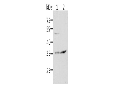 SOCS1 Polyclonal Antibody Store at -20°C - Biomarkers - Elabscience Biotechnology - MSE Supplies