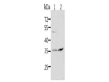 SOCS1 Polyclonal Antibody Store at -20°C