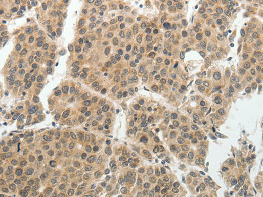 SOCS7 Polyclonal Antibody Store at -20°C - Biomarkers - Elabscience Biotechnology - MSE Supplies