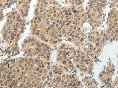 SOCS7 Polyclonal Antibody Store at -20°C - Biomarkers - Elabscience Biotechnology - MSE Supplies