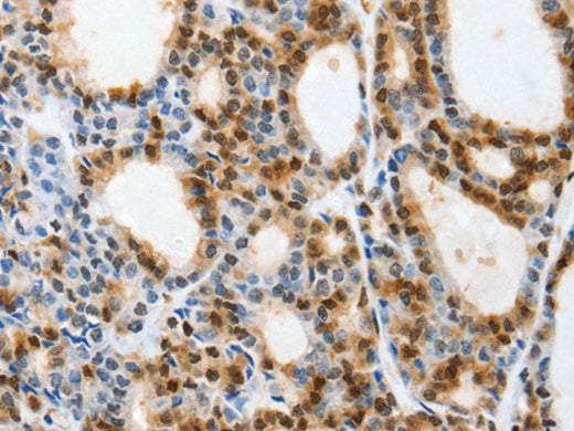 SELENOS Polyclonal Antibody Store at -20°C - Biomarkers - Elabscience Biotechnology - MSE Supplies