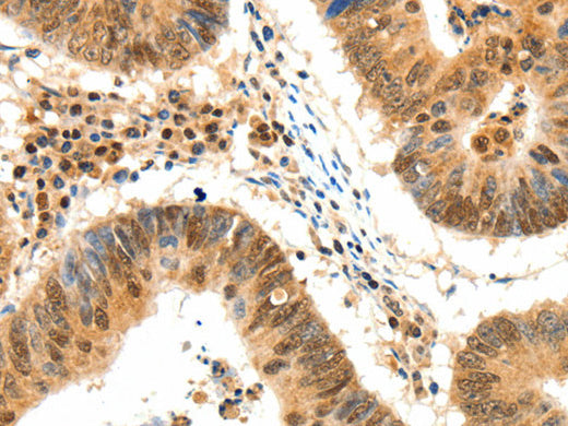 TERF2 Polyclonal Antibody Store at -20°C - Biomarkers - Elabscience Biotechnology - MSE Supplies