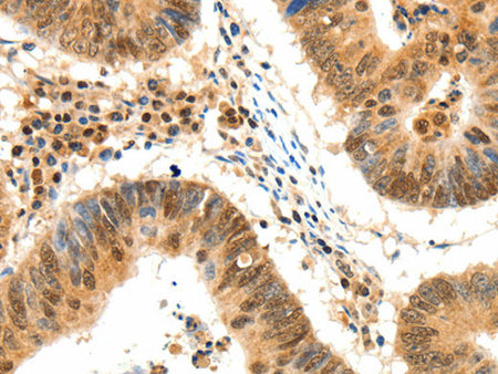 TERF2 Polyclonal Antibody Store at -20°C - Biomarkers - Elabscience Biotechnology - MSE Supplies