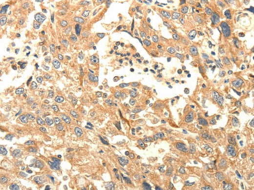 AGRN Polyclonal Antibody Store at -20°C - Biomarkers - Elabscience Biotechnology - MSE Supplies