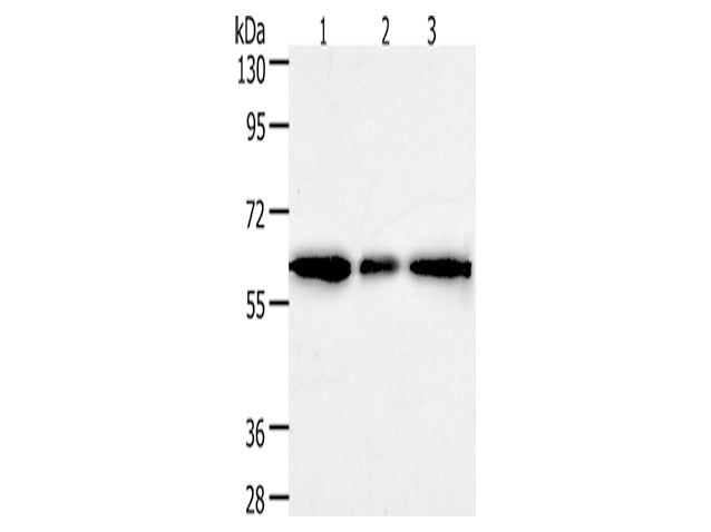 AKR1A1 Polyclonal Antibody Store at -20°C - Biomarkers - Elabscience Biotechnology - MSE Supplies
