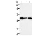 AKR1A1 Polyclonal Antibody Store at -20°C