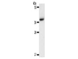 AKR1B1 Polyclonal Antibody Store at -20°C