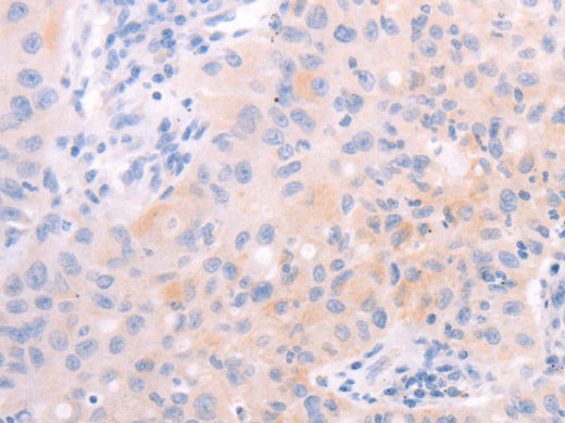 AMH Polyclonal Antibody Store at -20°C - Biomarkers - Elabscience Biotechnology - MSE Supplies