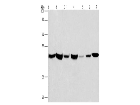 APMAP Polyclonal Antibody Store at -20°C - Biomarkers - Elabscience Biotechnology - MSE Supplies